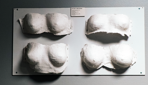 gipsavstøpninger av bryst