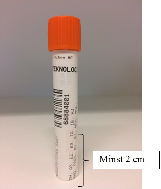 Visuell forklaring til merking av prøvebeholder.