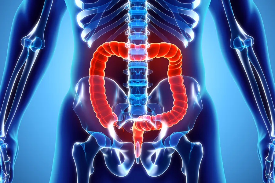 illustrasjon av tarmsystemet