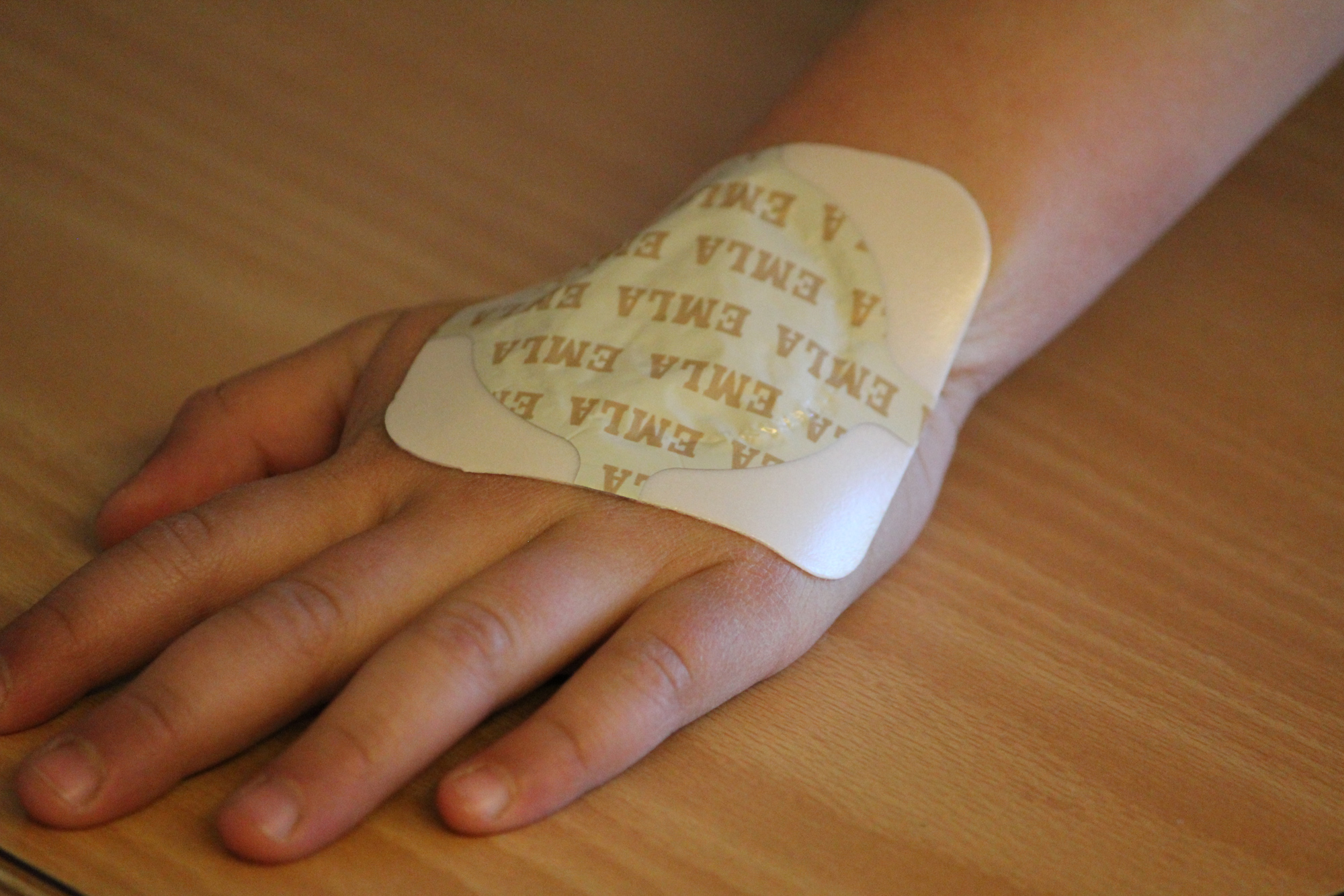 Emla bedøvelses-plaster.