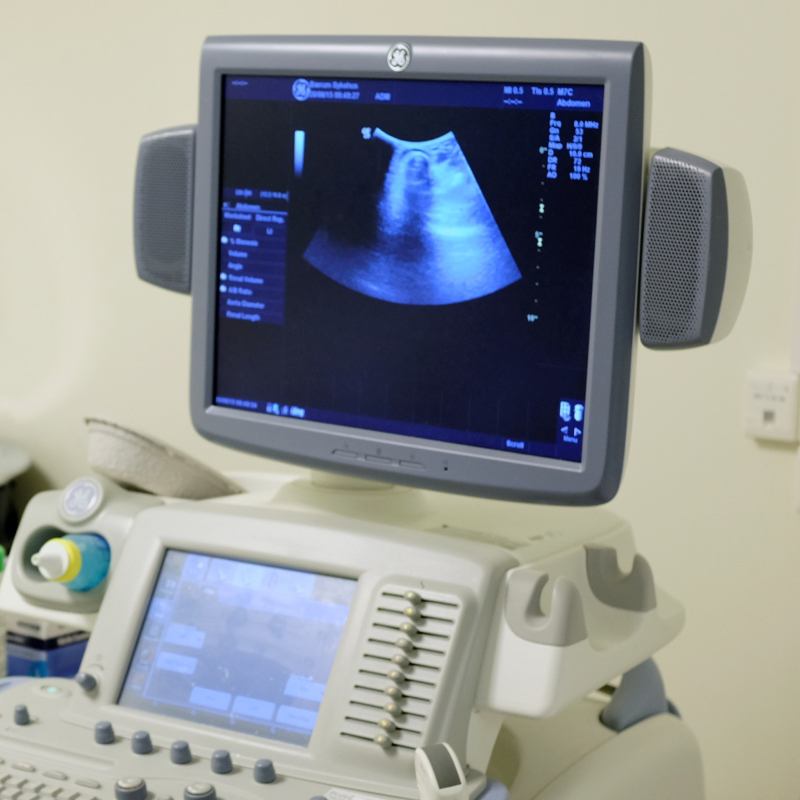 En dataskjerm og et tastatur