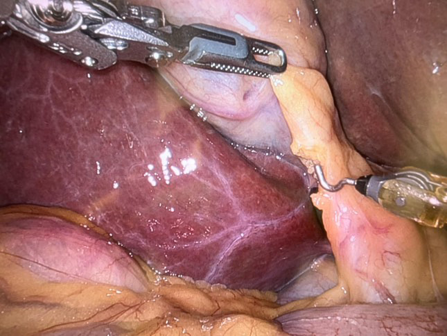 Et nærbilde av en persons munn