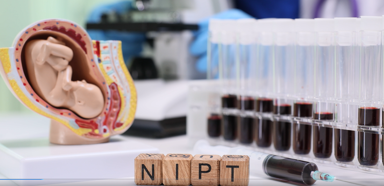 Illustrasjon av NIPT-test for gravide