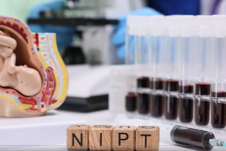 Illustrasjon av NIPT-test for gravide