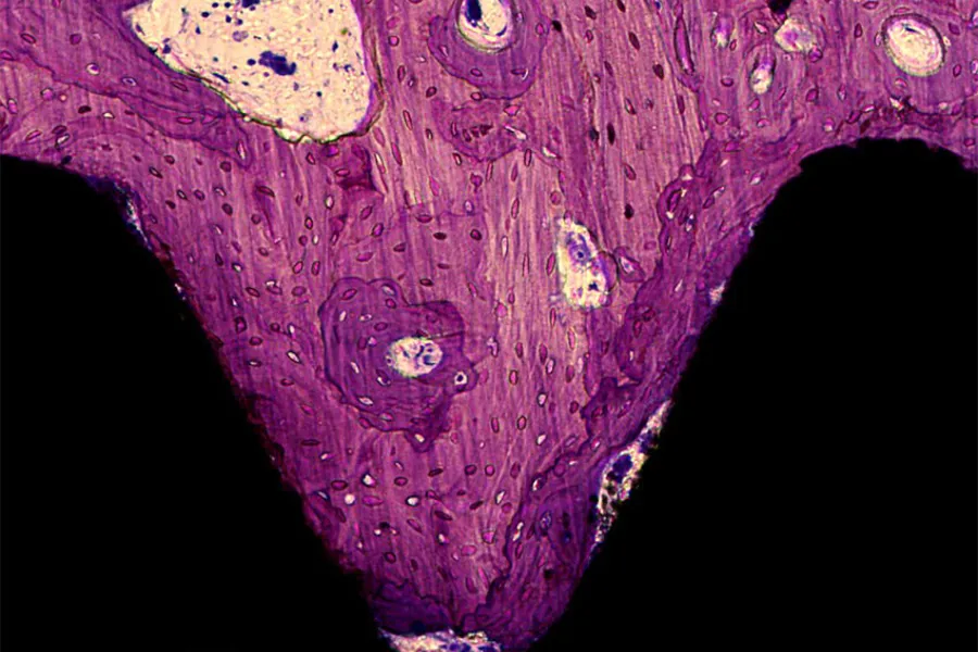 Osseointegrert titanskrue. Beinvev i lilla, implantat i svart. Intimkontakt mellom bein og implantat sees langs størstedelen av implantatoverflaten. Mikroskop 400 x, eget preparat, kanintibia.