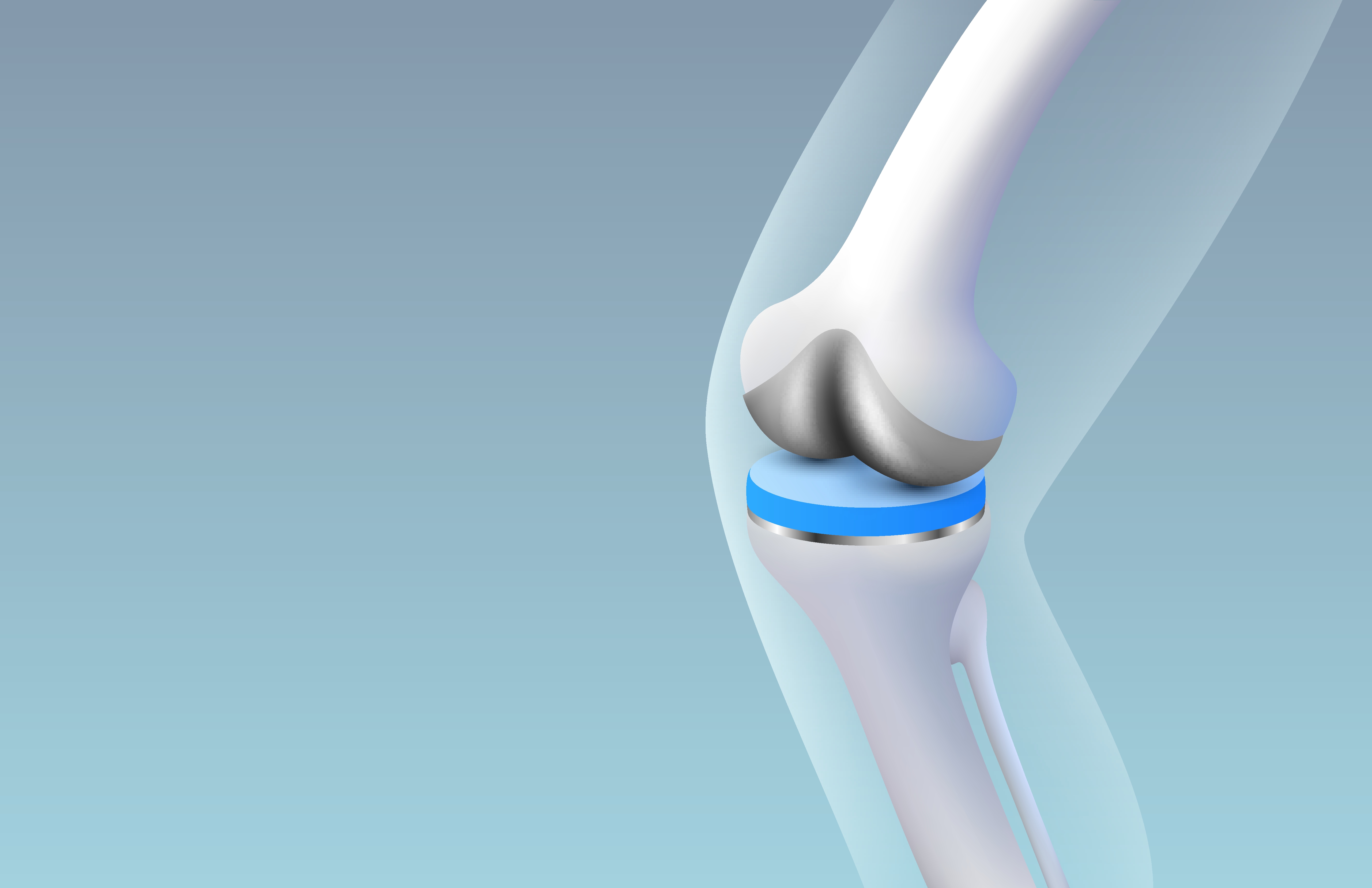 illustrasjon av kneprotese