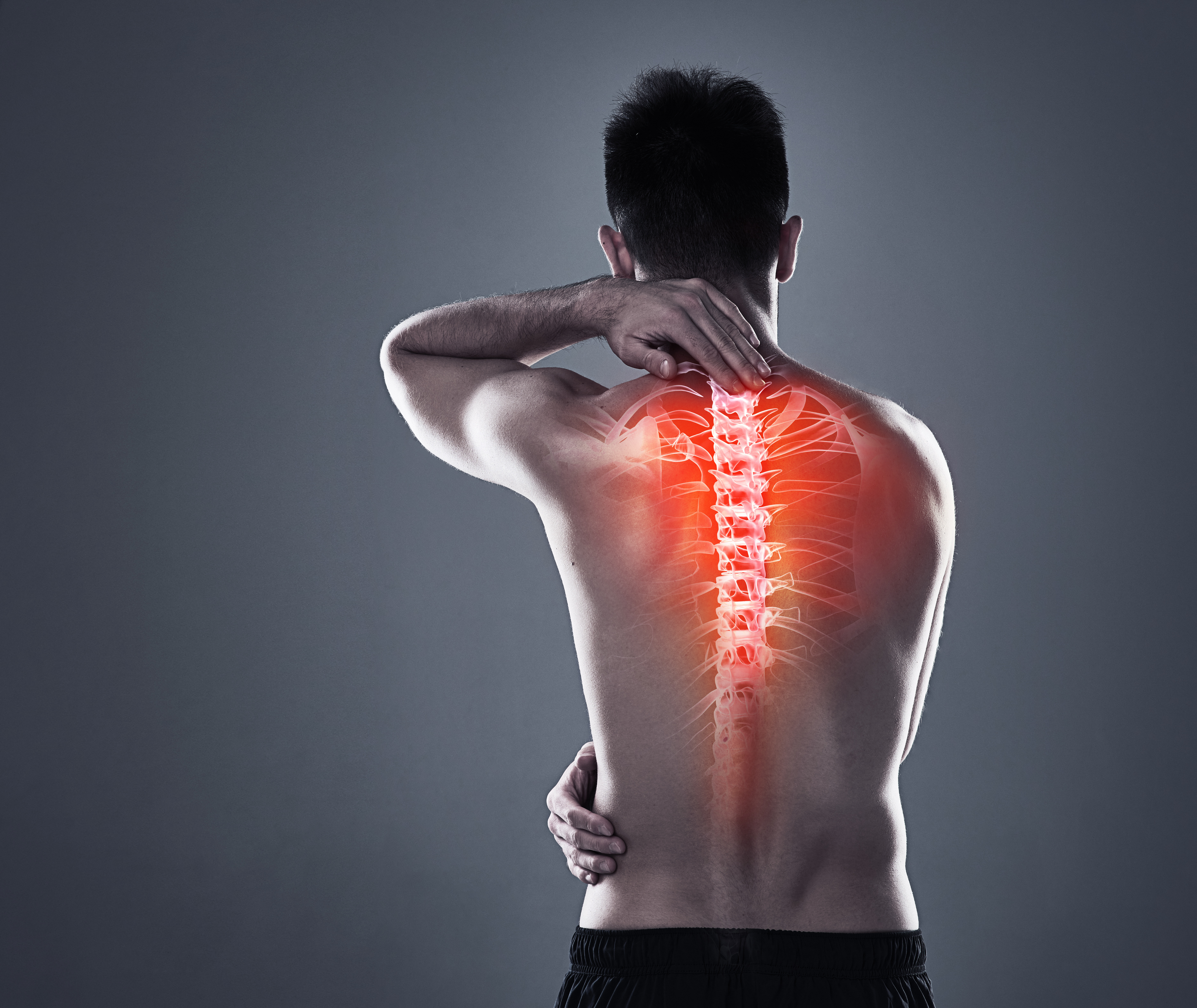 illustrasjon av person med spinal stenose
